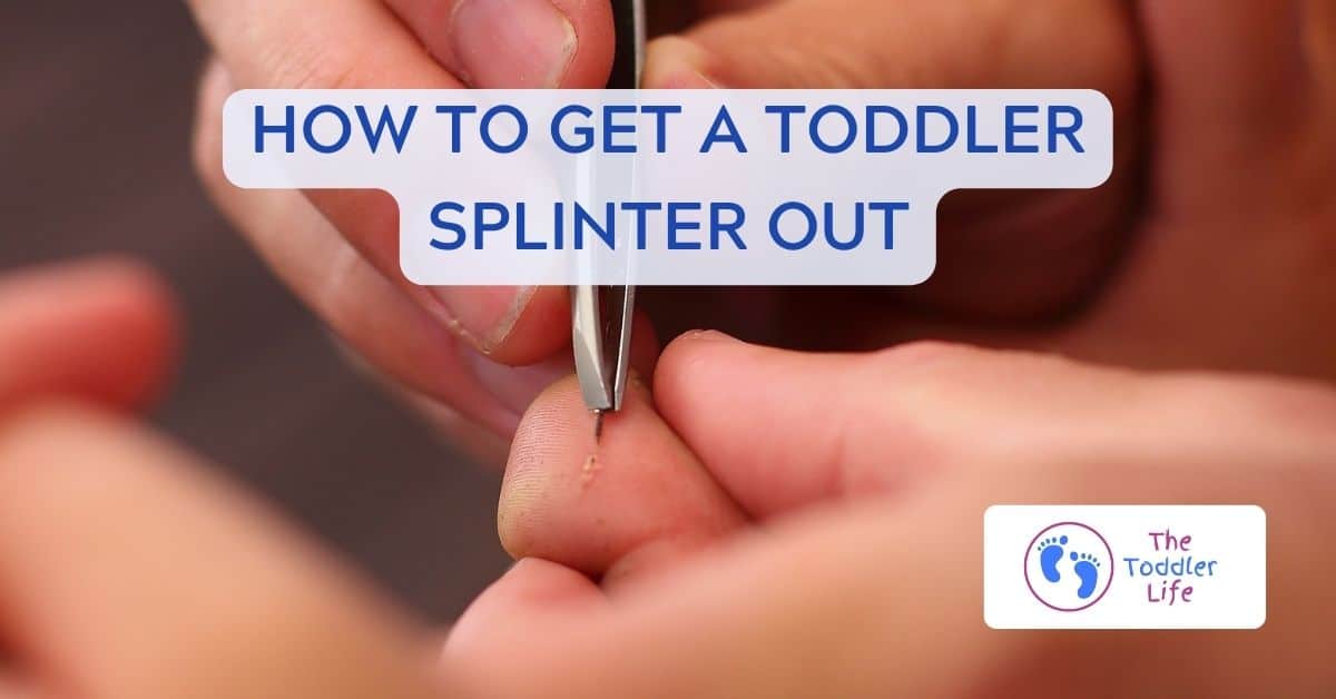 splinter removal from toddler